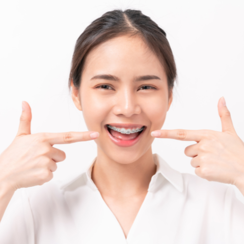 Person smiling with clear aligners